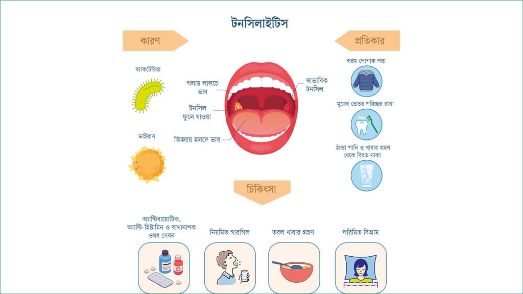 শীতে টনসিলের ব্যথা কমাতে