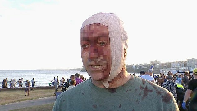 বন্ডাই বিচে আহত এই ব্যক্তি ইসরায়েলে হামাসের হামলার মুখেও পড়েছিলেন