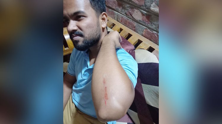 আহত মোহাম্মদ হাসান। ছবি: সংগৃহীত