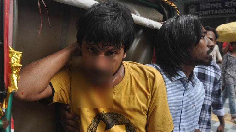 চট্টগ্রামে গণতান্ত্রিক ছাত্রজোট ও শাহবাগবিরোধী মঞ্চের সংঘর্ষে আহত ব্যক্তিরা। ছবি: আজকের পত্রিকা