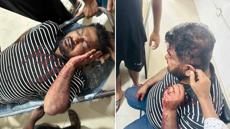 খুলনায় ট্যাংক-লরি সমিতির নেতাসহ ৩ জন গুলিবিদ্ধ। ছবি: আজকের পত্রিকা