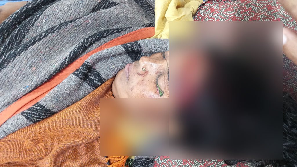 আমতলীতে ধান কাটতে বাধা দেওয়ায় চার নারীসহ পাঁচজনকে কুপিয়ে জখম