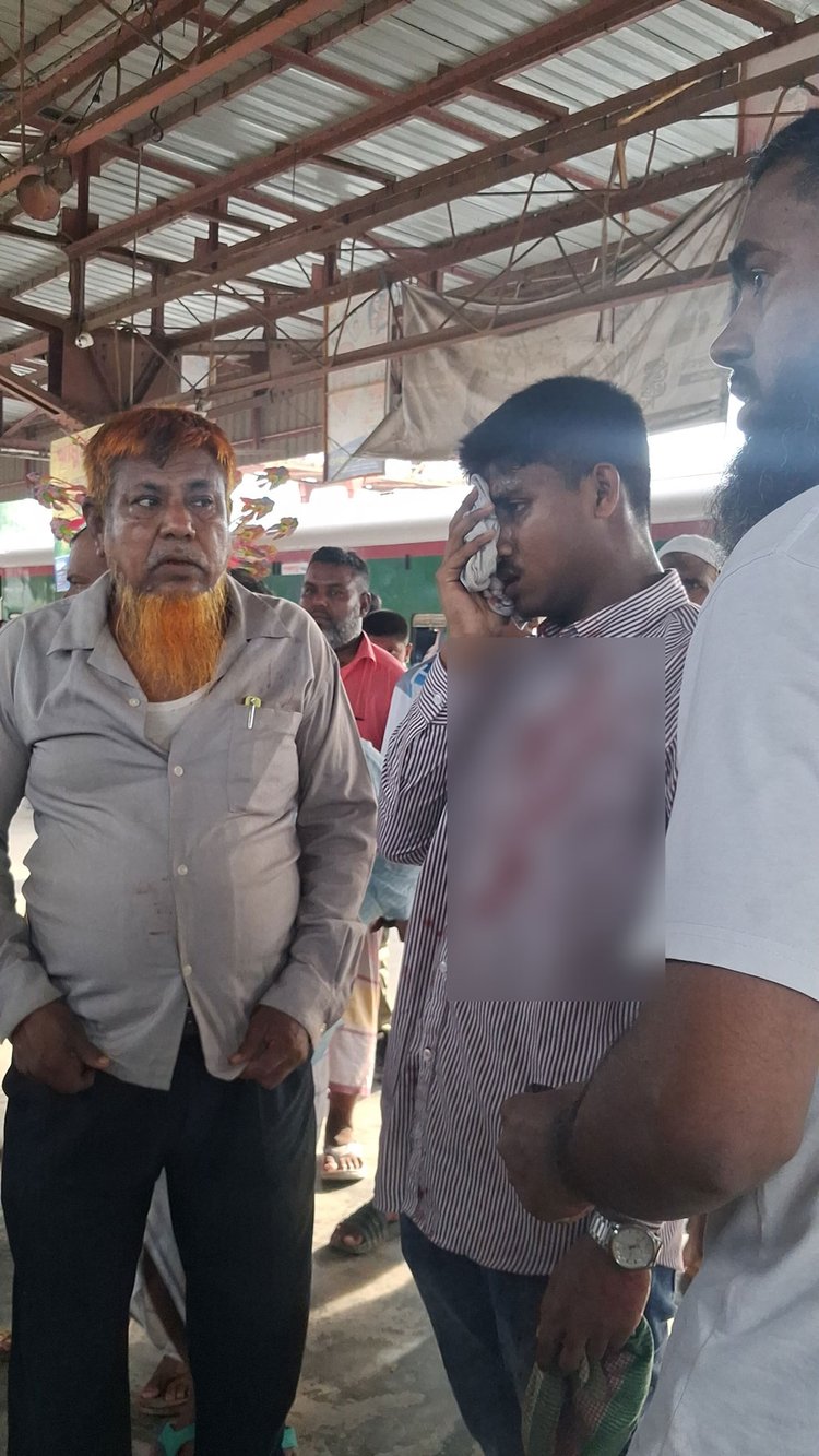পাথর নিক্ষেপে চোখে আঘাত পাওয়া যুবক। ছবি: আজকের পত্রিকা