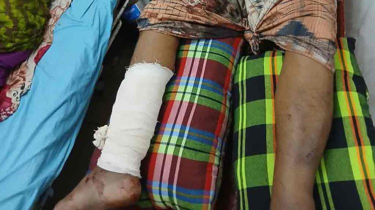 মিরপুরে সরকারি কর্মকর্তা-কর্মচারীদের জন্য নির্মিত আবাসন প্রকল্পের ভবনের লিফট ছিঁড়ে পড়ে তিনজন আহত হন। ছবি: আজকের পত্রিকা