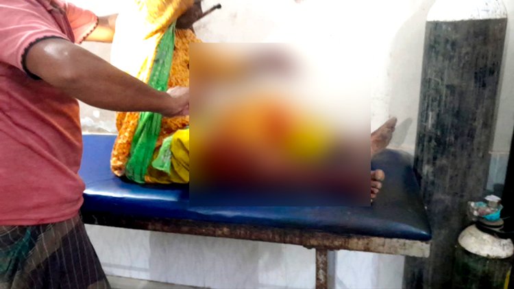 বন্যপ্রাণীর আক্রমণে আহত ব্যক্তিরা। ছবি: আজকের পত্রিকা