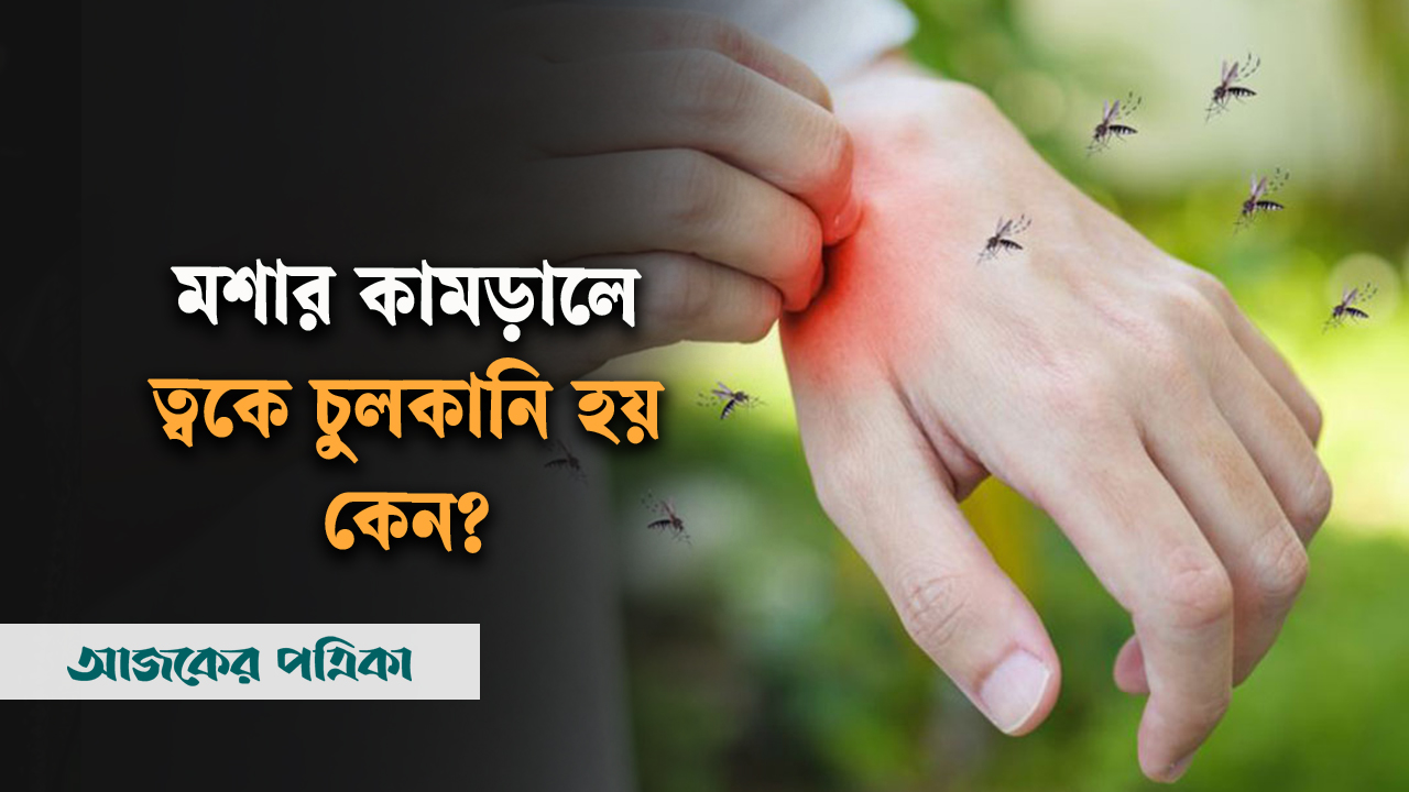 মশা কামড়ালে চুলকায় কেন?