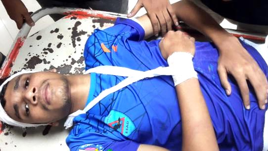 চবি ছাত্রলীগে দুই পক্ষের সংঘর্ষ, আহত ৪