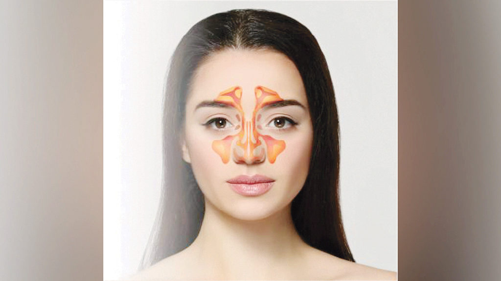 সাইনোসাইটিসের সংক্রমণ যেভাবে প্রতিরোধ করবেন