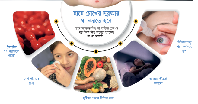 হামের কারণে চোখের ক্ষতি এড়াতে কী করবেন