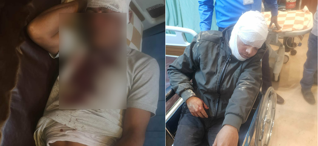 মহাসড়কে প্রাইভেট কার থামিয়ে পাঁচজনকে কুপিয়ে জখম