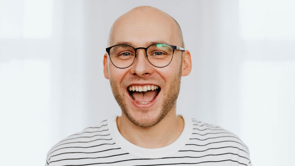 মাথার ওপর মরুকরণ: কেন বিশ্বজুড়ে কমছে পুরুষের চুলের ঘনত্ব