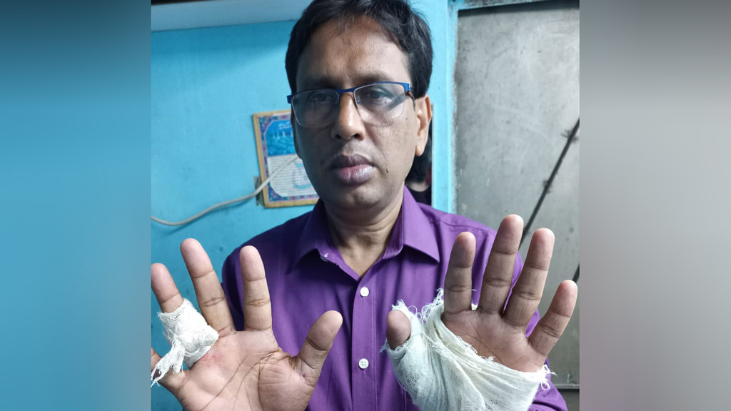 চাঁদার দাবিতে শিক্ষা কর্মকর্তাকে হাতুড়ি পেটার অভিযোগ