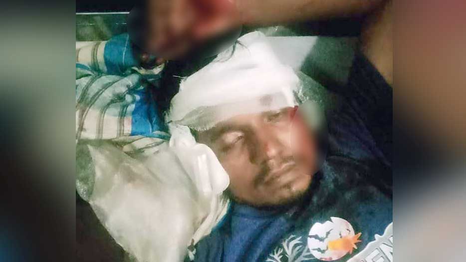 আখাউড়ায় ট্রেনে ছোড়া ঢিলে আহত ১ 