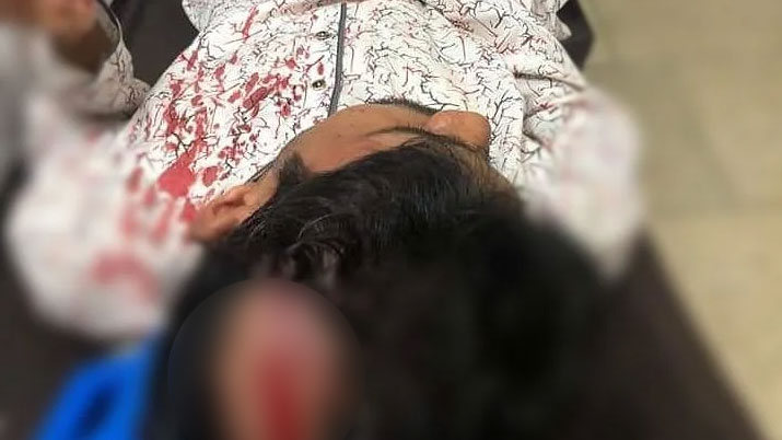 সম্মেলনের দাবি নিয়ে ঢাবিতে আসা সিলেটের নেতার মাথা ফাটাল ছাত্রলীগ নেতাকর্মীরা