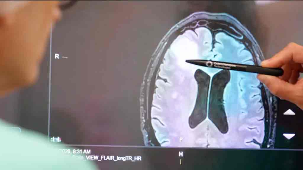 প্রায় দুই মাসের বদলে মাত্র দুই ঘণ্টায় শনাক্ত হবে মস্তিষ্কের টিউমার