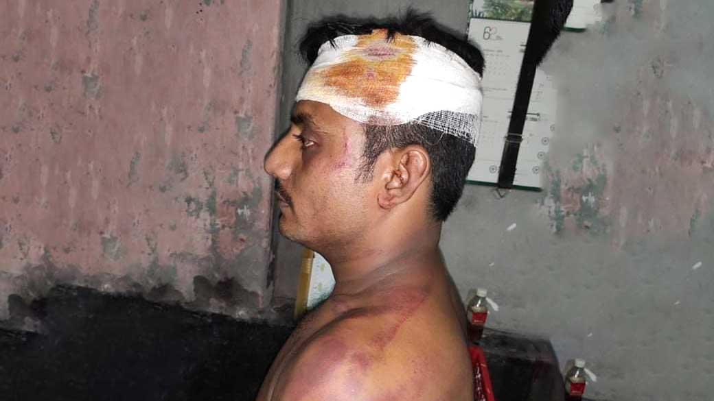 ভোট না দেওয়ায় গ্রাম ছাড়া করার হুমকি, পিটিয়ে জখম