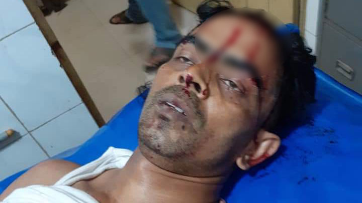 শিবপুরে আইনজীবীর ওপর সন্ত্রাসী হামলা