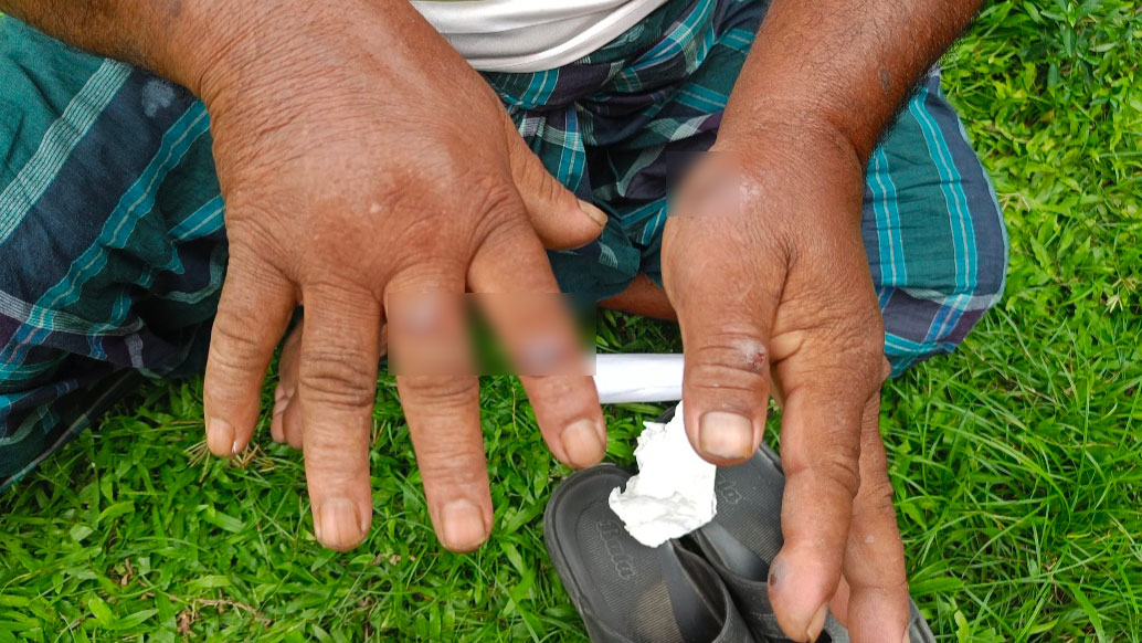 সুন্দরগঞ্জে আতঙ্ক ছড়াচ্ছে অ্যানথ্রাক্স