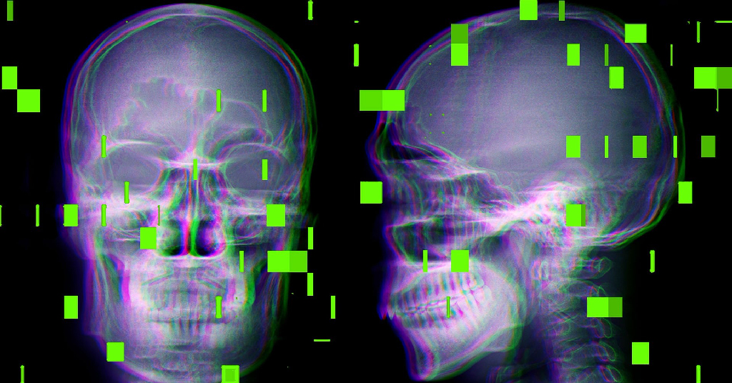 অপারেশন থিয়েটারে এআই—ভুল সার্জারির অভিযোগ বাড়ছে