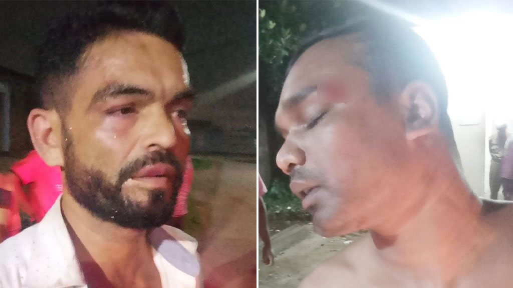 সিইউএফএলে ট্রাক সরানো নিয়ে উত্তেজনা, আনসার সদস্যদের মারধরের অভিযোগ
