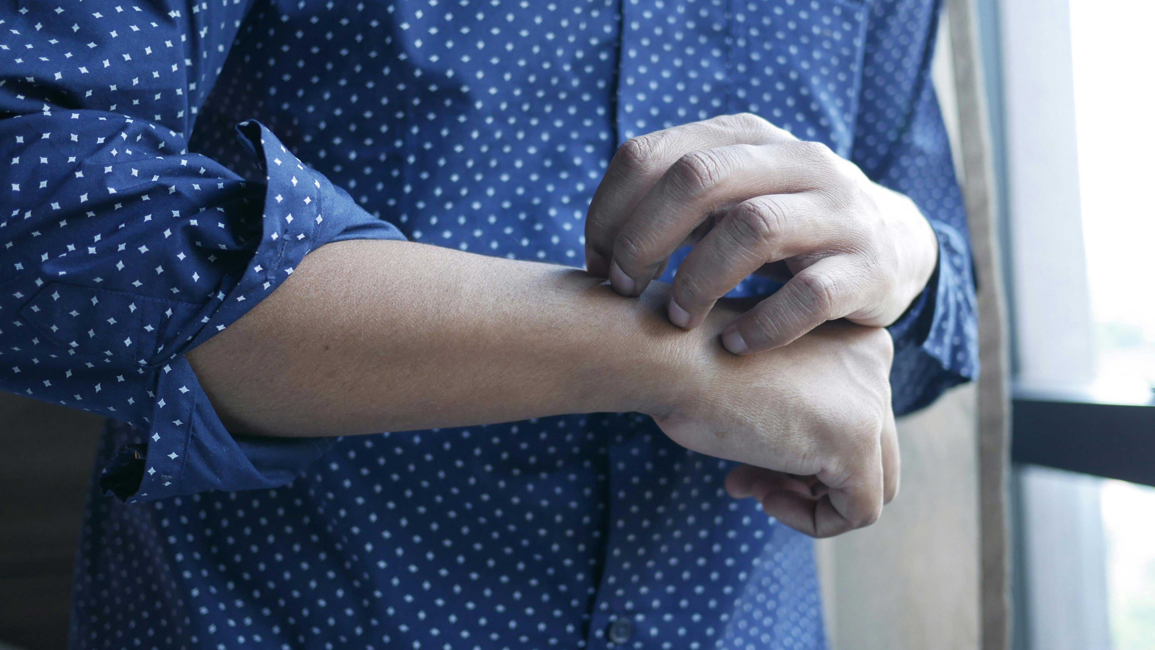 মানসিক সমস্যার কারণে চুলকানি হলে কী করবেন