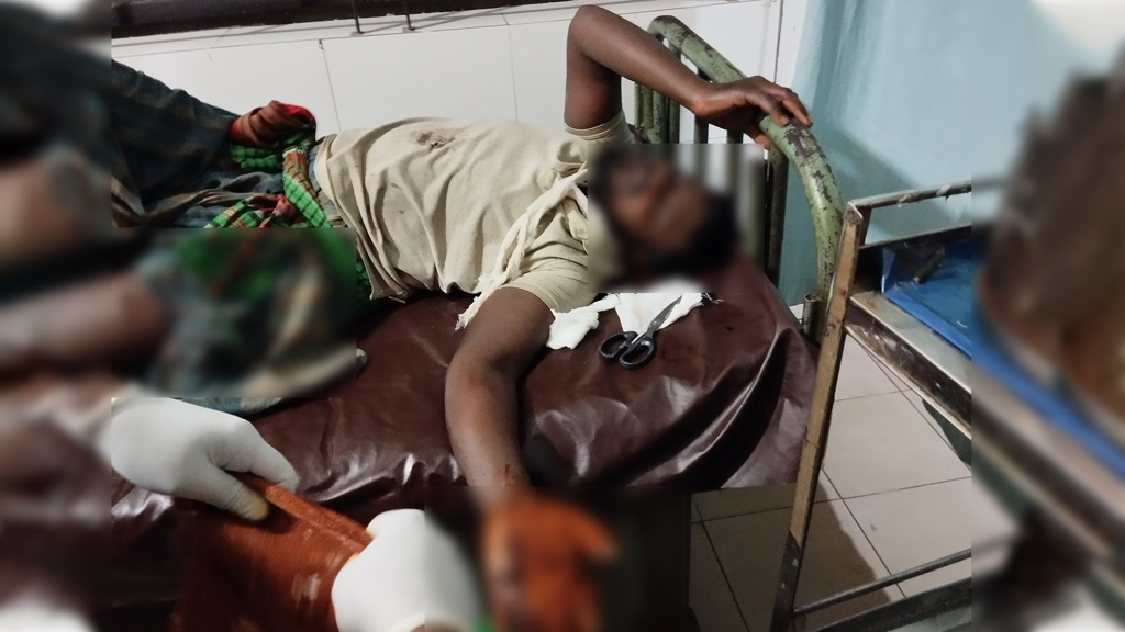 যাত্রাবাড়ীতে ঘাস কাটার সময় পরিত্যক্ত ককটেল বিস্ফোরণে যুবক আহত