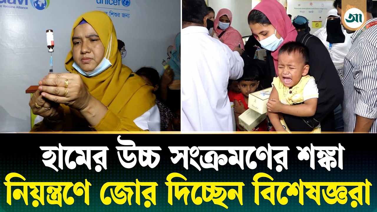 আরও ৫ থেকে ৬ সপ্তাহ হামের উচ্চ সংক্রমণের শঙ্কা