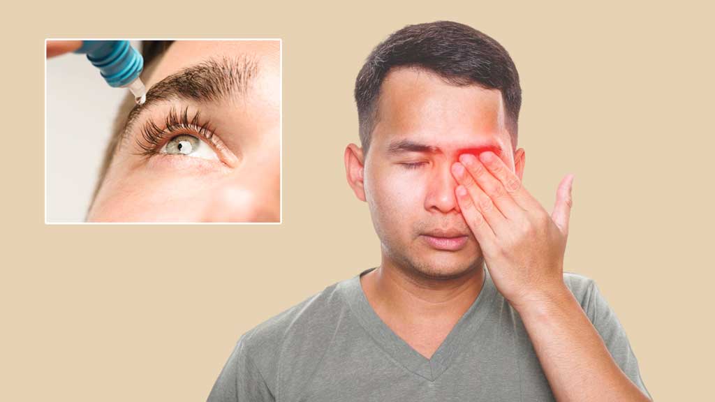 চোখ আগুনে ক্ষতিগ্রস্ত হলে কী করা জরুরি