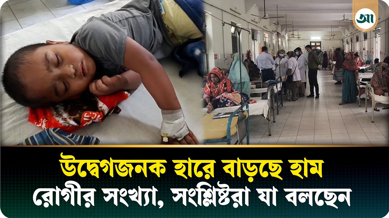 বেড়েই চলছে হাম রোগীর সংখ্যা, হাসপাতালে যে দৃশ্য দেখা গেল
