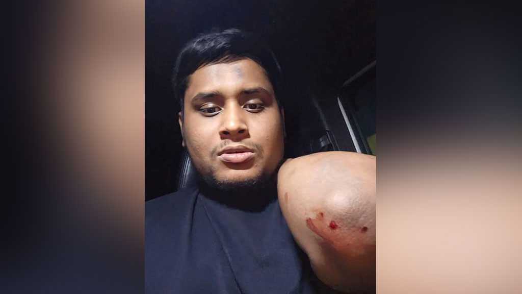 গাজীপুরে হাসনাত আবদুল্লাহর গাড়িতে হামলার অভিযোগ