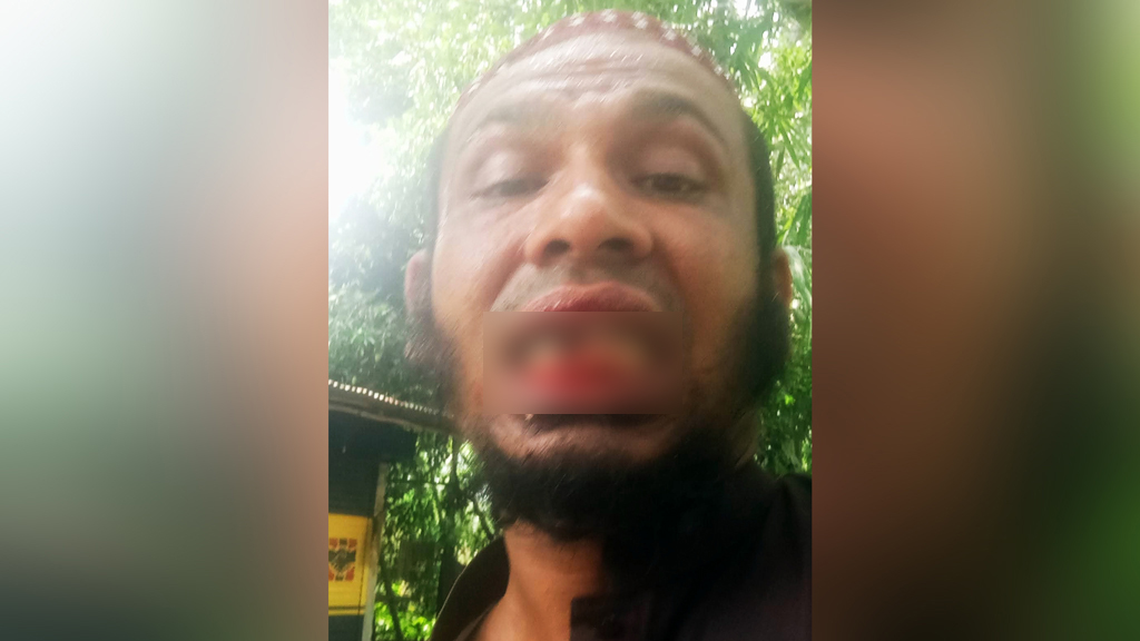 কলেজের অধ্যক্ষের ঘুষিতে ভাঙল কম্পিউটার অপারেটরের দাঁত