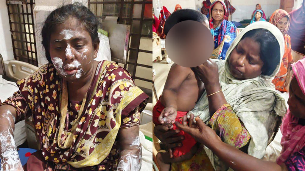 কেশবপুরে সিগারেট থেকে ভবনে অগ্নিকাণ্ড, এক পরিবারসহ দগ্ধ ৭