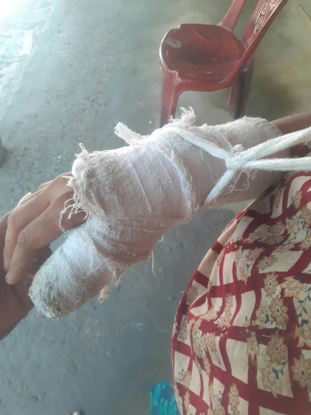 নেত্রকোনায় নারীকে শ্লীলতাহানীর পর ইটের আঘাতে ভেঙে দেওয়া হয় আঙুল, থানায় অভিযোগ