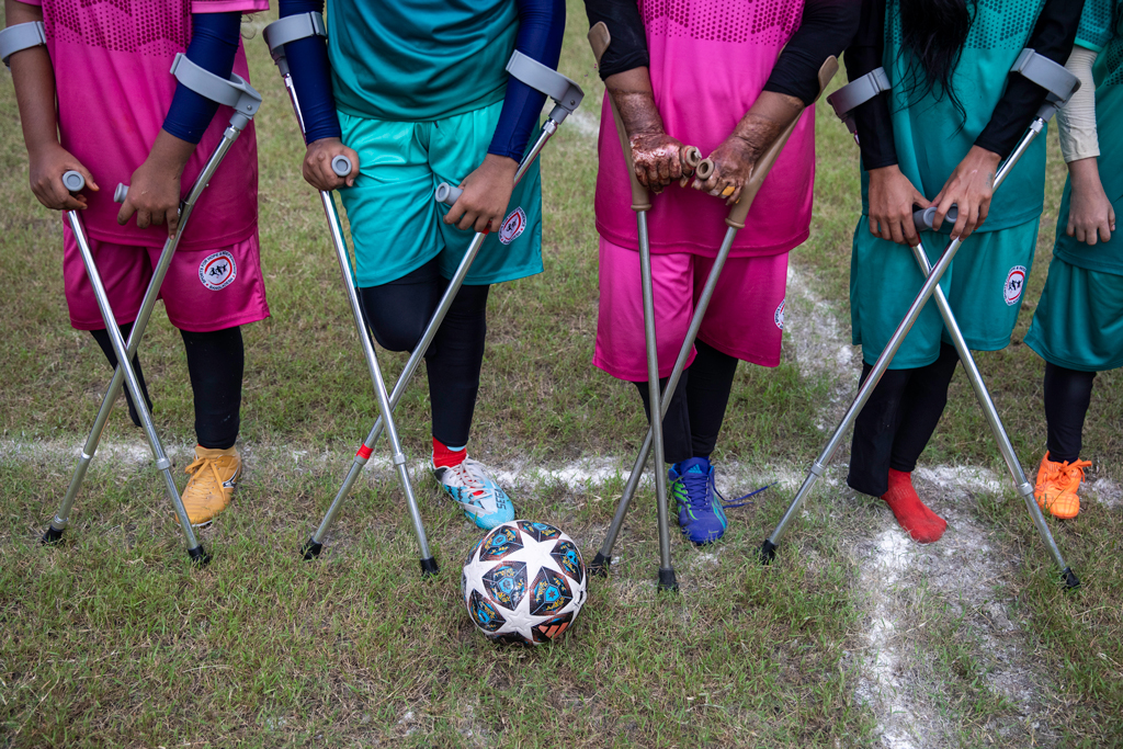 অ্যামপিউটিদের আরও আত্মবিশ্বাস করে গড়ে তুলতে এই খেলার আয়োজন। ছবি: হাসান রাজা