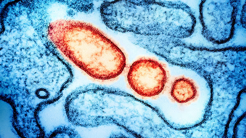 ভারতে শনাক্ত নিপাহ ভাইরাসকে কেন অবহেলার সুযোগ নেই বিশ্বের