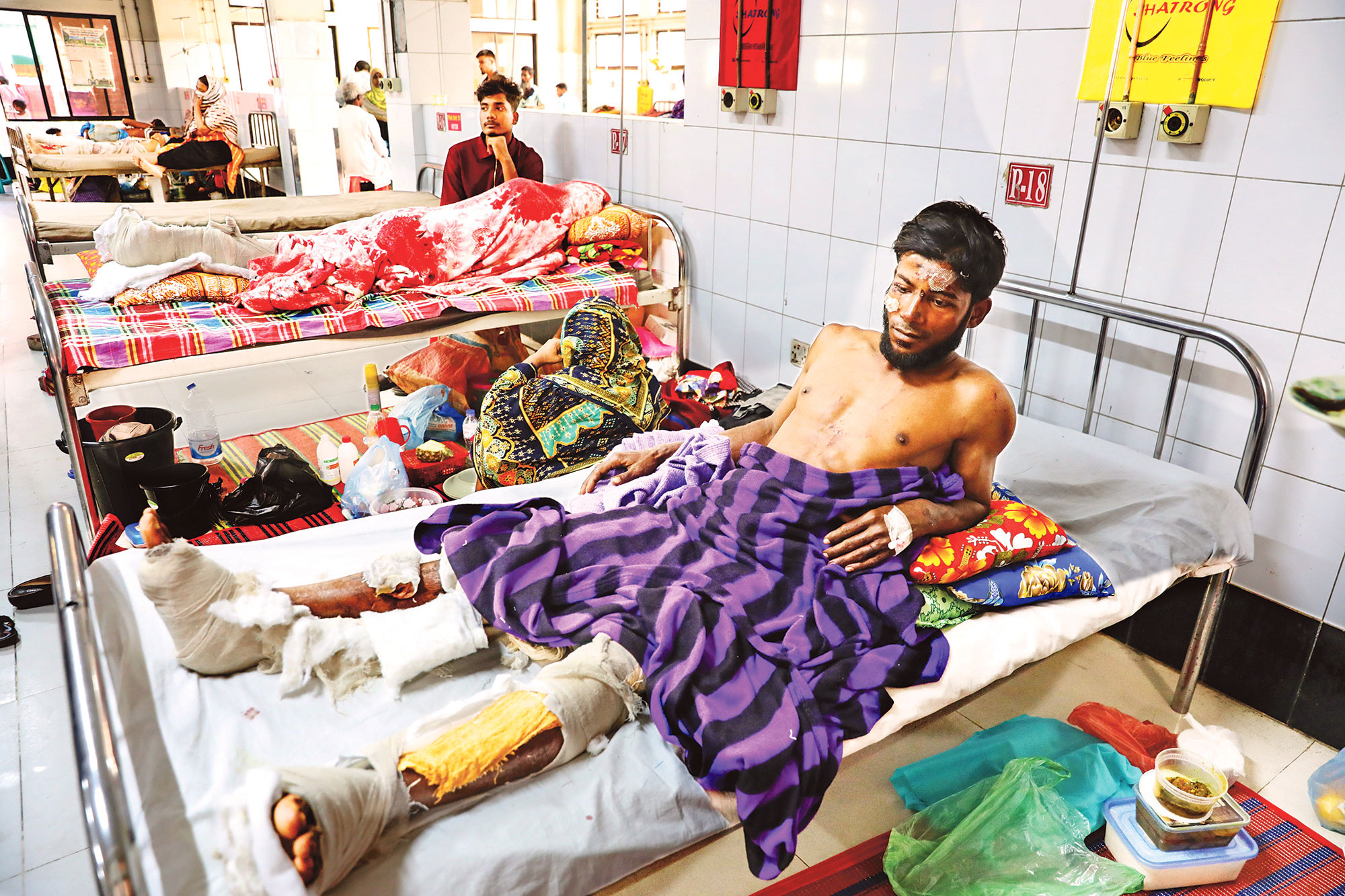 ভয়ে ছোটাছুটিতেই আহত হয় বেশি