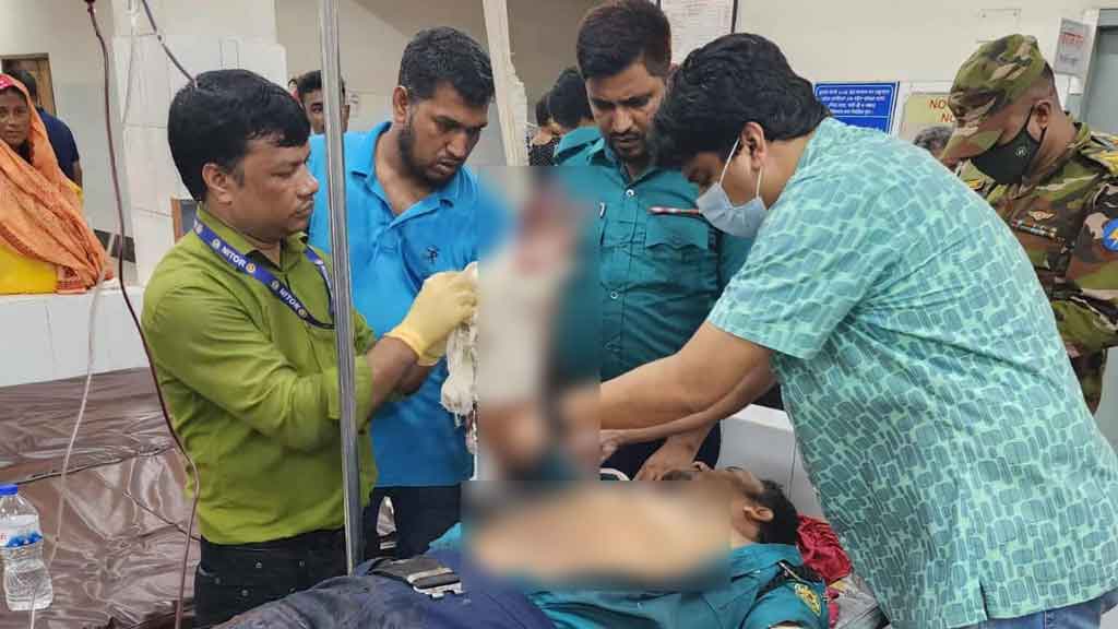 আদাবরে কিশোর গ্যাংয়ের হামলায় ৩ পুলিশ সদস্য আহত, টহল গাড়ি ভাঙচুর