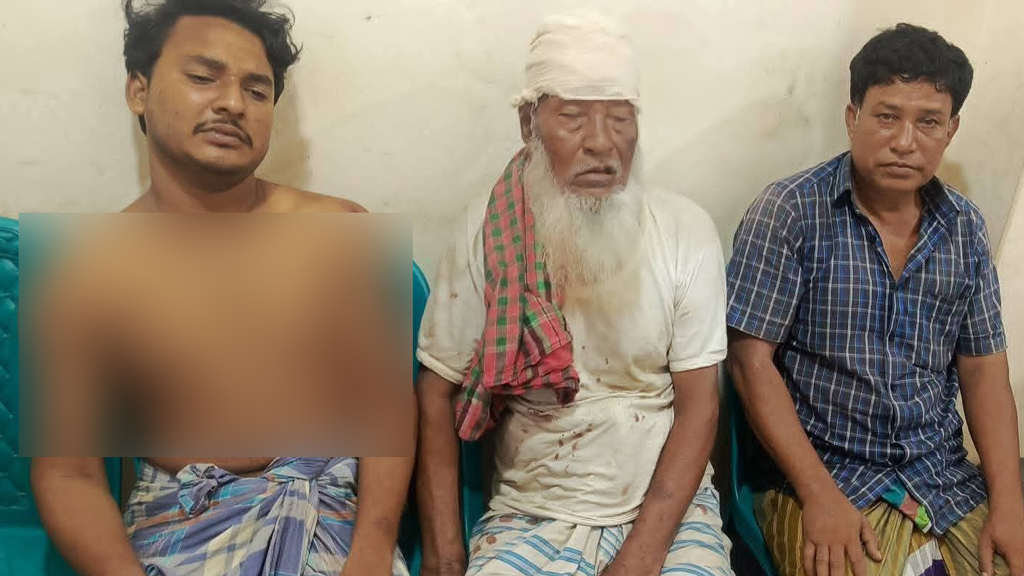 হাতিয়ায় জমি নিয়ে বিরোধের জেরে হামলা, ৫ জনকে কুপিয়ে জখম
