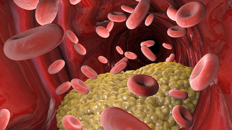 শীতকালে কেন কিছু মানুষকে রক্ত পাতলা করার ওষুধ খেতে হয়