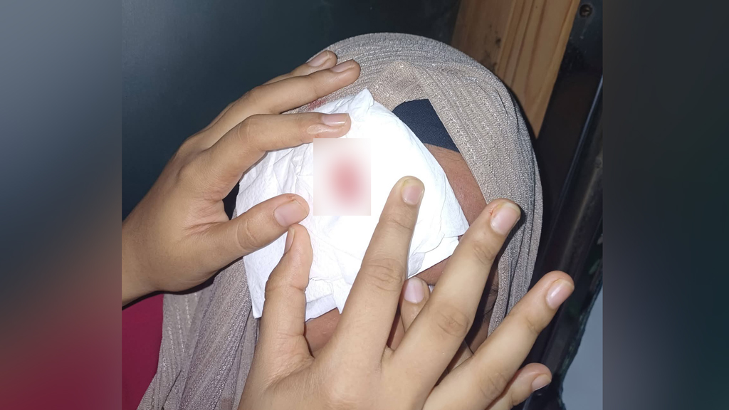 শাটল ট্রেনে পাথরে মাথা ফাটল চবি শিক্ষার্থীর