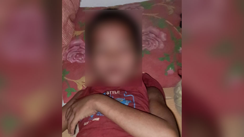 নাইক্ষ্যংছড়ির দুর্গম ইয়াংনি মুরুংপাড়ায় হামের প্রাদুর্ভাব, আক্রান্ত ৯ শিশু