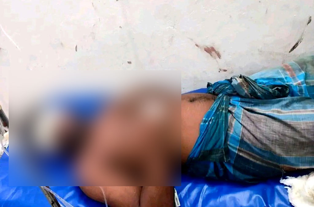 ভোলায় যুবককে তুলে নিয়ে দুই চোখ উপড়াল প্রতিপক্ষ