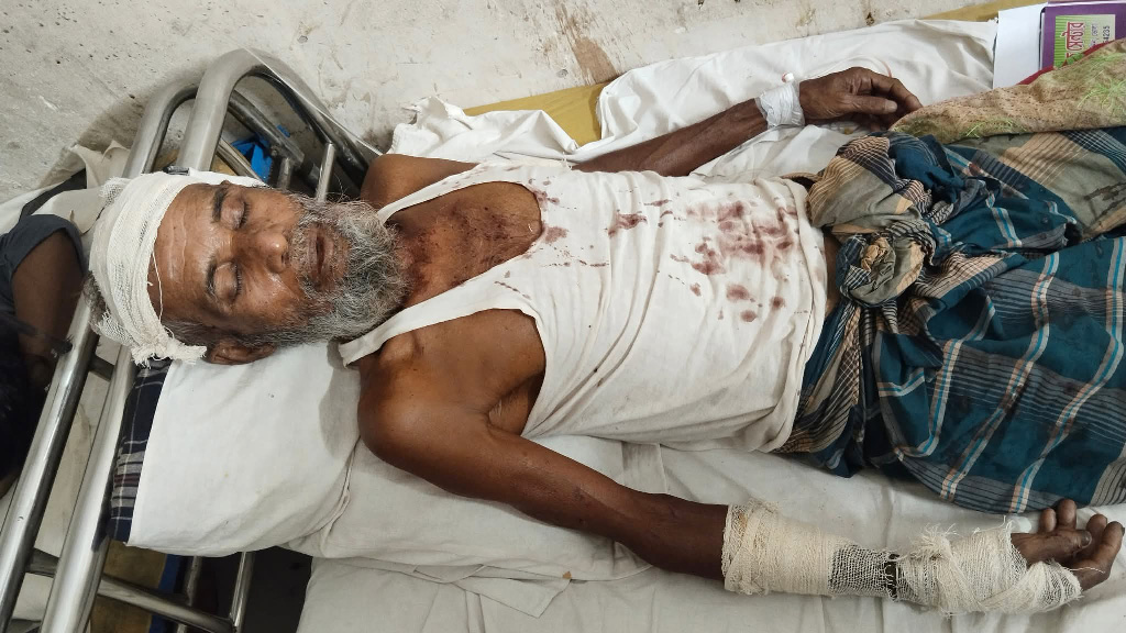 ভোলায় চাঁদার দাবিতে বৃদ্ধকে কুপিয়ে জখম, অভিযোগ বিএনপির কর্মীর বিরুদ্ধে