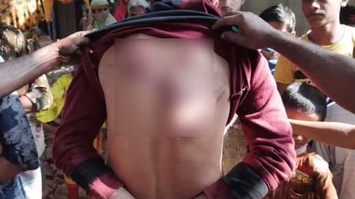 তুলে নিয়ে নির্যাতন করে যুবককে বিবস্ত্র অবস্থায় ফেলে গেল দুর্বৃত্তরা