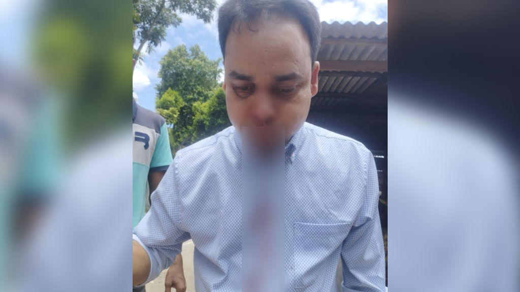 ডেকে নিয়ে ফার্মাসিস্টের ওপর হামলা