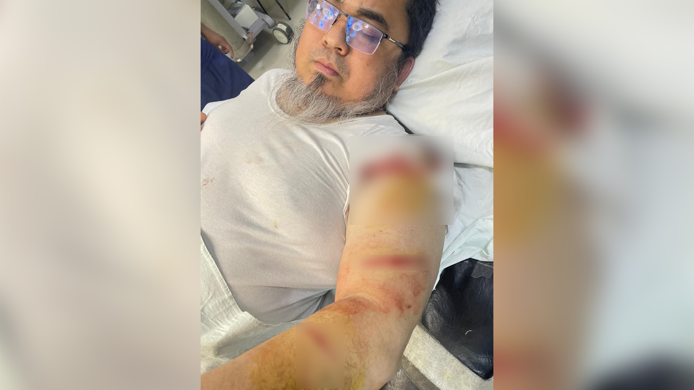 জাতীয় ক্যানসার হাসপাতালের উপপরিচালককে ছুরিকাঘাত