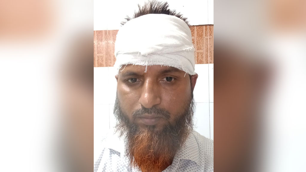 গভীর মেঘনায় জেলেদের হামলা, মৎস্য কর্মকর্তাসহ আহত ১০