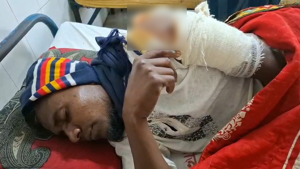 ফরিদপুরে ১১ দলের ইউনিয়ন কমিটির আহ্বায়ককে কুপিয়ে ও হাতুড়ি দিয়ে পিটিয়ে জখম