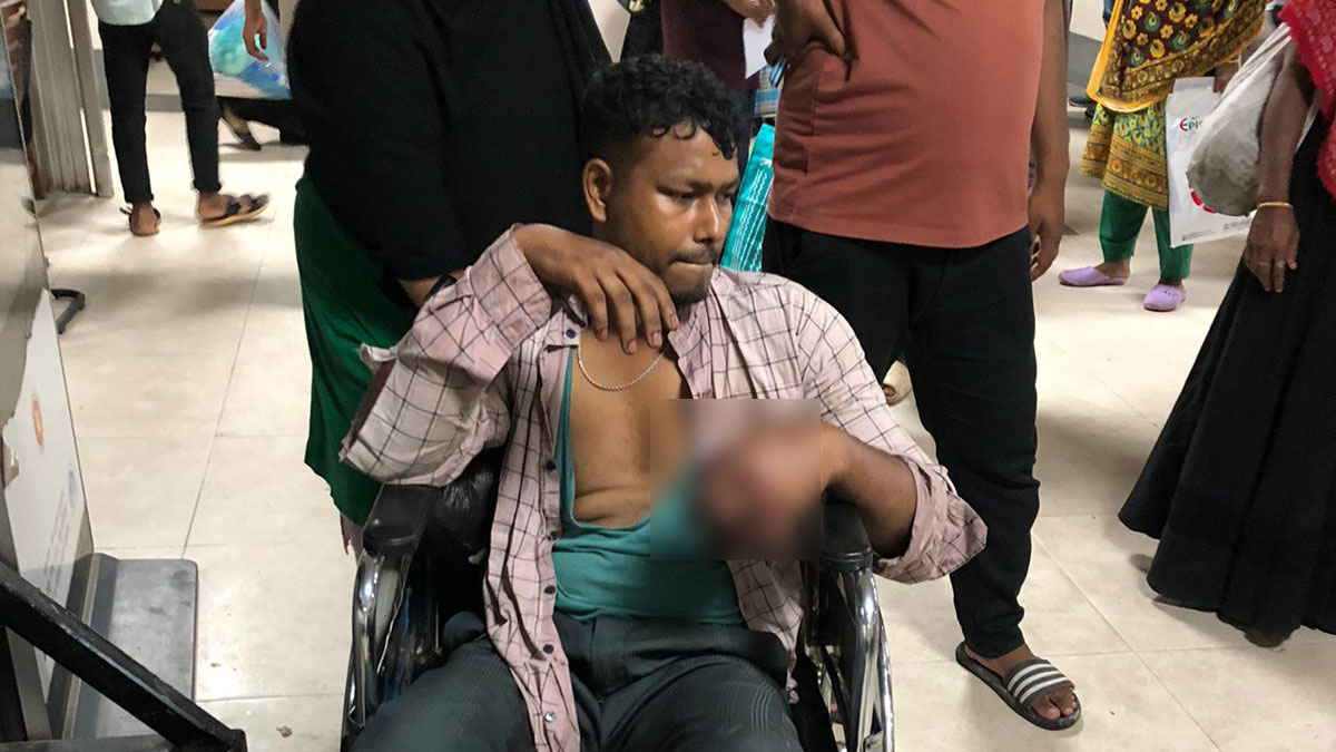 যুবককে বেঁধে নির্যাতন, হাত-পায়ের নখ তুলে ফেলার অভিযোগ নারীর বিরুদ্ধে