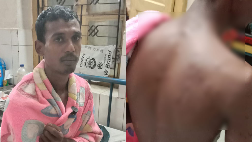 জীবননগর সীমান্তে বিএসএফের গুলিতে বাংলাদেশি যুবক আহত